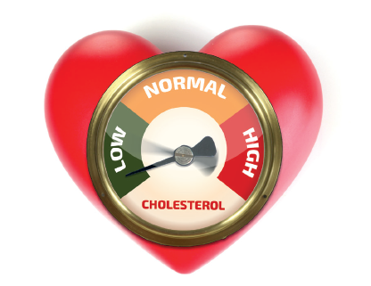 Cholesterol Nl